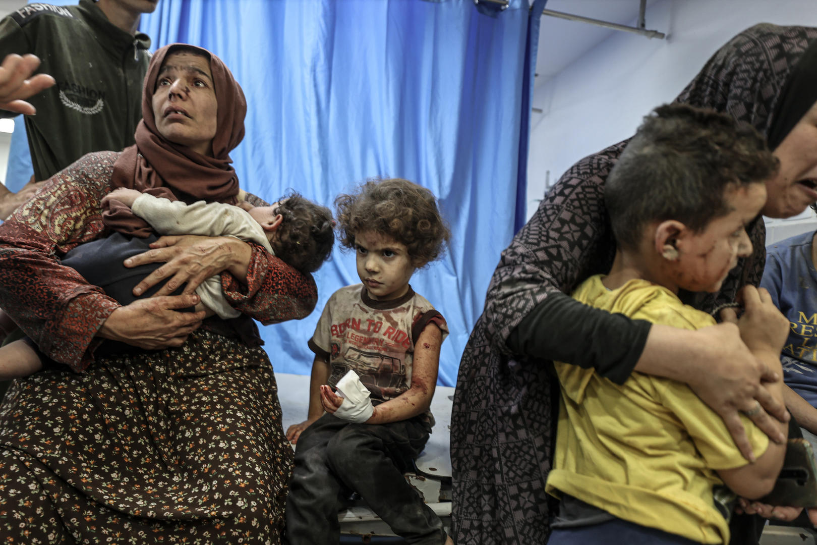 ▲加沙城希法医院里在以军空袭中受伤的儿童。资料图