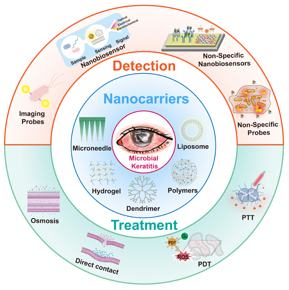 纳米医学眼部细菌感染检测和治疗总览图。