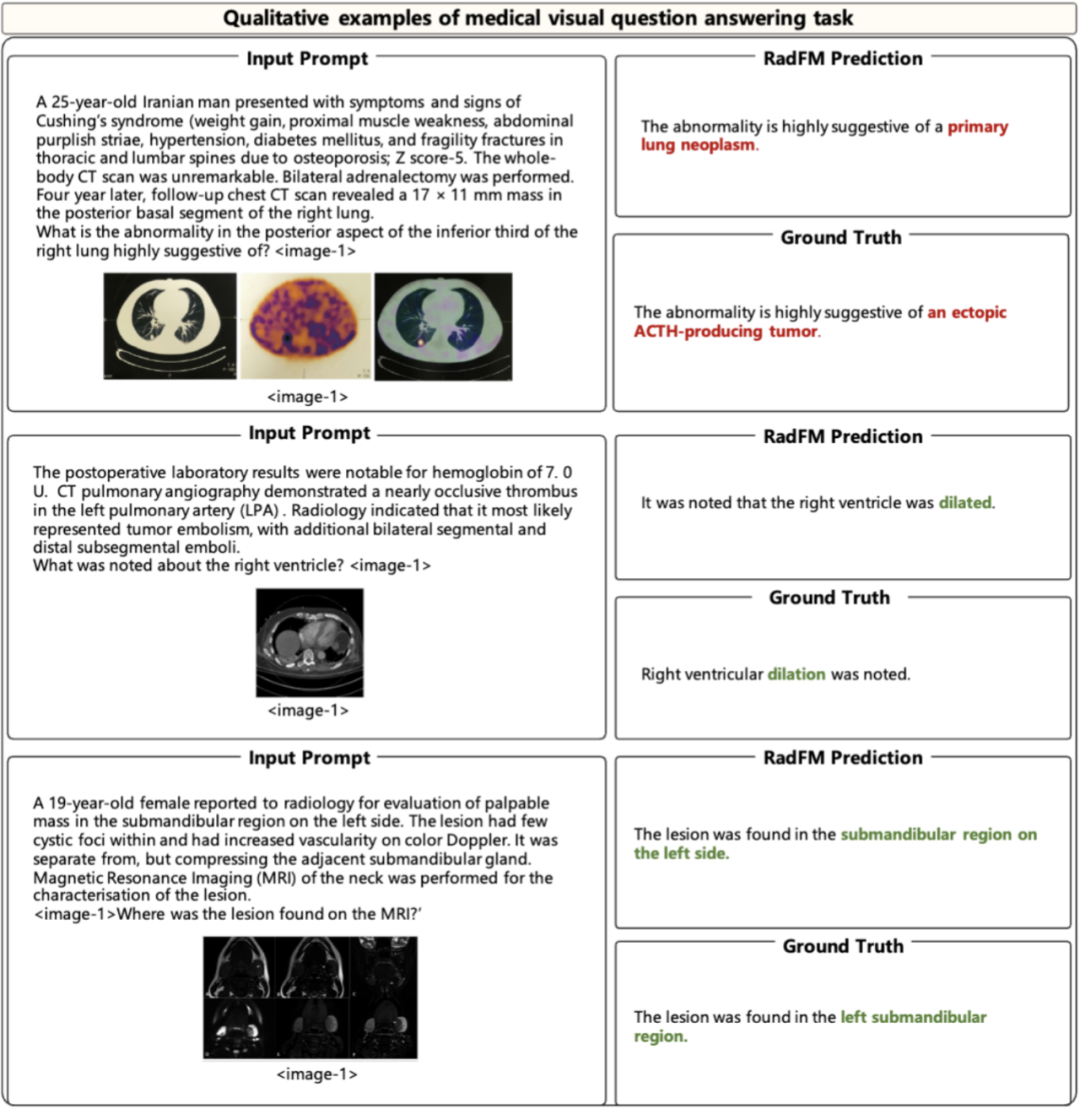 图 8: RadFM 在 Medical VQA 任务上的性能展示