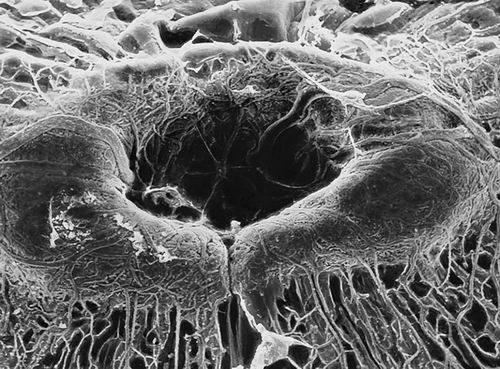 严重眼病与肠道细菌存在惊人联系