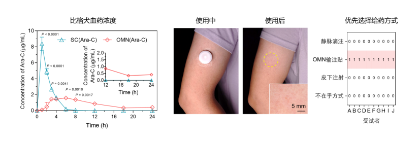输注贴的比格犬药动结果（左）；受试者使用输注贴前后照片（中）；受试者对输注贴接受度的问卷调查结果（右）