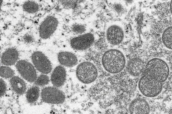 多国出现猴痘病例，会成为另一个大规模传染病吗