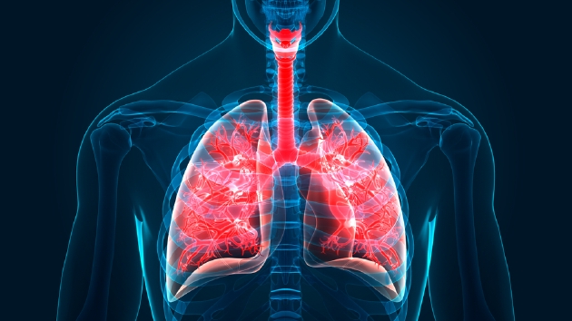科学家在人体肺部发现一种新类型细胞，它在保持呼吸系统正常运转方面发挥着重要作用。