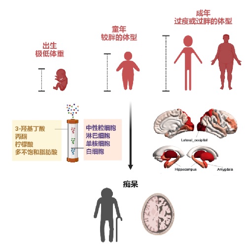 全生命周期体重与痴呆风险的关联及可能机制 受访者供图